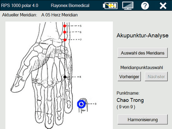 Rayoscan® Software-Erweiterung: Akupunktur-Analyse