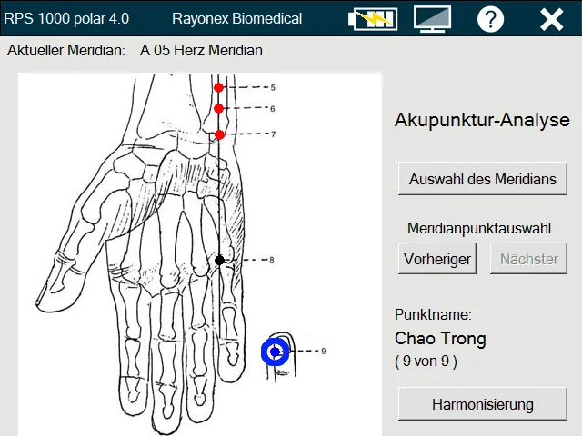 Rayoscan® Akupunktur-Analyse, Softwareansicht mit Handgrafik und Punktauswahl Chao Trong